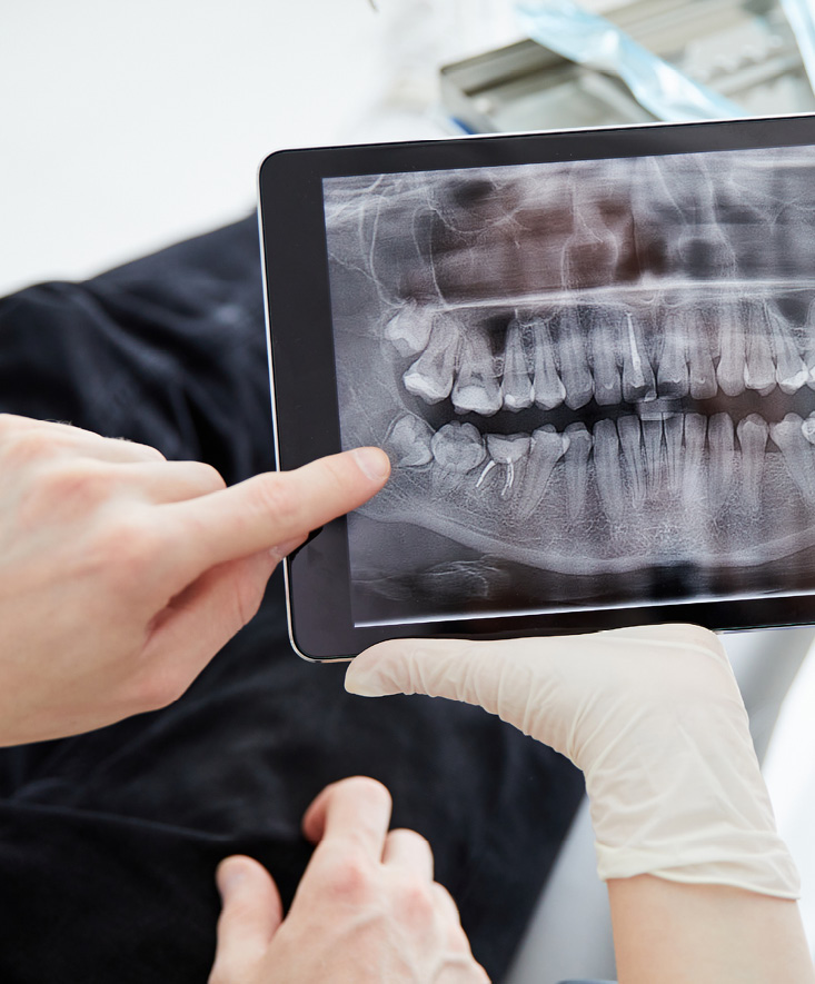 A dental x-ray displayed on a tablet